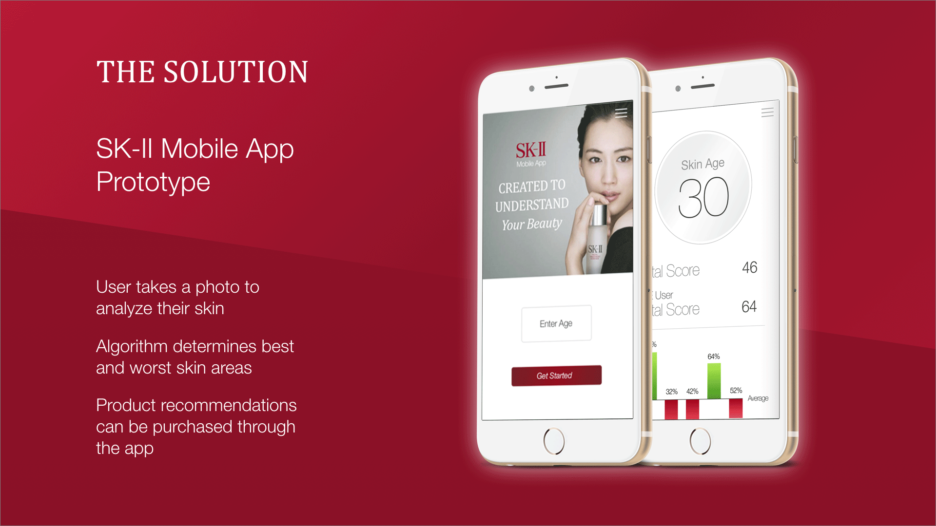 SK-II.04